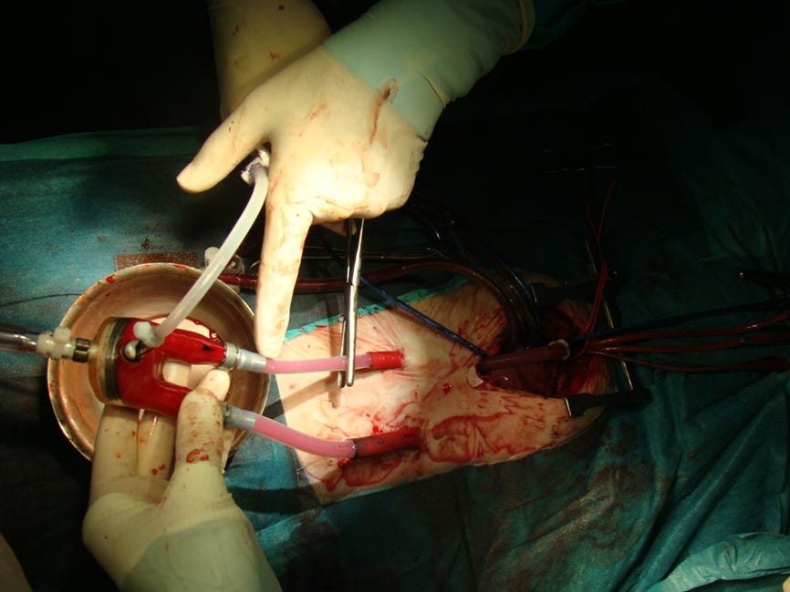Frecuencia cardiaca bebe 8 meses